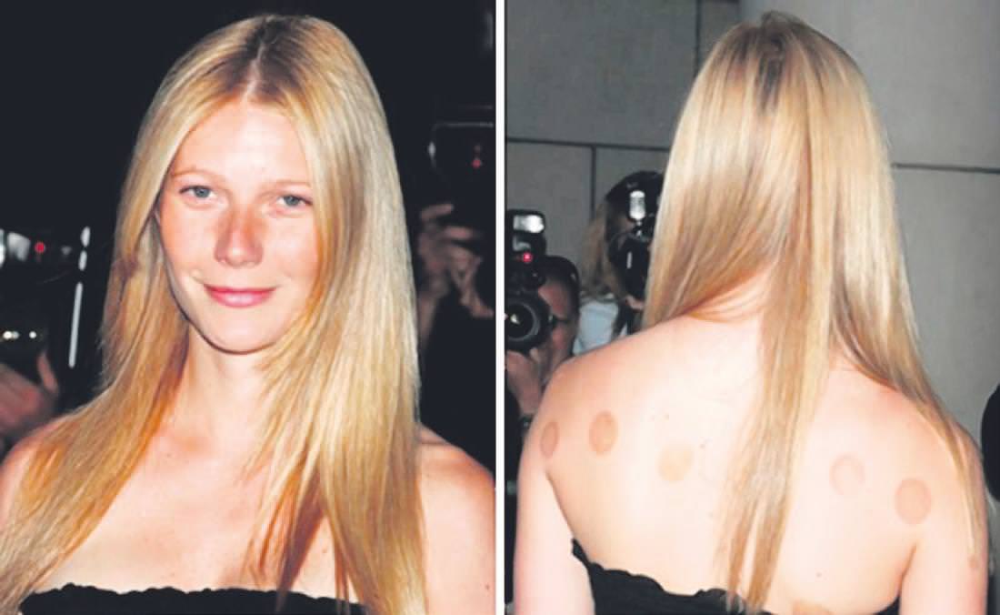 Hacamat Yaptıran Ünlüler